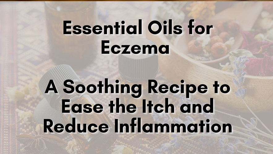 Essential Oils for Eczema: A Soothing Recipe to Ease the Itch and ...